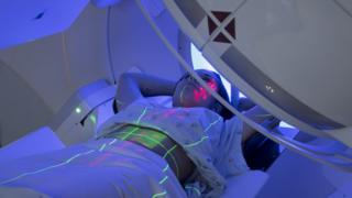 Breast cancer: One-dose radiotherapy ‘as effective as full course’
