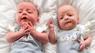 Separated twins’ parents thank Colchester nurses for pictures