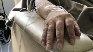 Chemotherapy in cancer patients with Covid-19 ‘not a risk’
