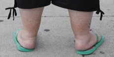 Poor Diet, Not Less Exercise, is Main Cause of Childhood Obesity