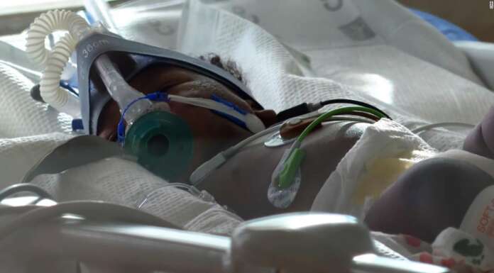 From newborns to teens, this hospital has a deluge of young Covid-19 patients. Here’s what parents want others to know
